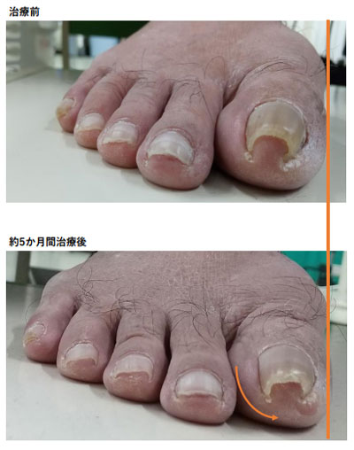 その他の治療症例